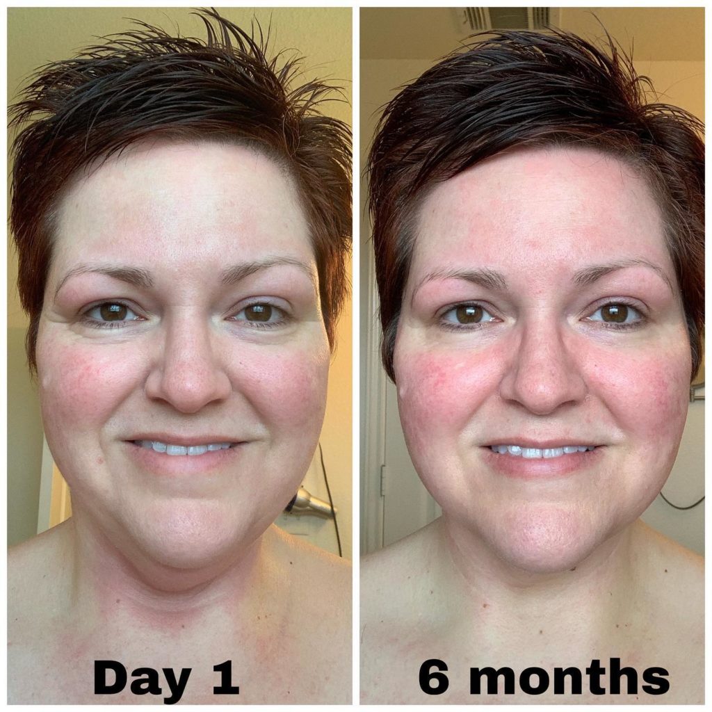 six months of progress on collagen